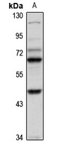 TBX5 Rabbit Polyclonal Antibody