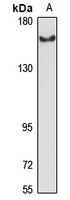 CA150 Rabbit Polyclonal Antibody
