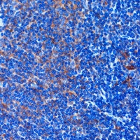 TCIRG1 antibody