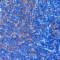 Anti-TCIRG1 Antibody