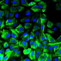 Anti-TCIRG1 Antibody