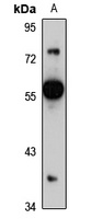 TCP11L2 Antibody