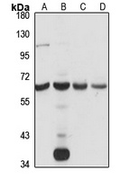 TCTE1 Antibody