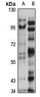 Tectonic-1 Rabbit Polyclonal Antibody