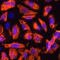 Tectonic-1 Rabbit Polyclonal Antibody