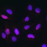Anti-TDP1 Antibody