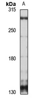 Teneurin-1 Rabbit Polyclonal Antibody