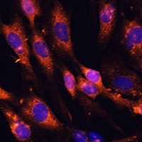 Teneurin-1 Rabbit Polyclonal Antibody
