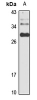 Tescalcin Rabbit Polyclonal Antibody