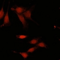 Anti-TET3 Antibody