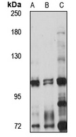 TEX11 Rabbit Polyclonal Antibody