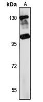 TEX2 Rabbit Polyclonal Antibody