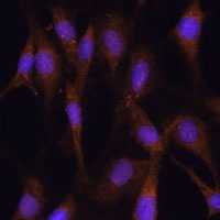 4 Rabbit Polyclonal Antibody (AP)