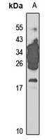 Trefoil Factor 3 Rabbit Polyclonal Antibody