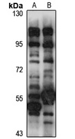 TRAP1 Rabbit Polyclonal Antibody