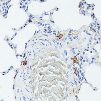 TIAR antibody
