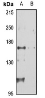 TIAM1 Rabbit Polyclonal Antibody