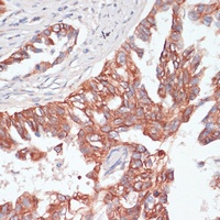 Anti-TIAM1 Antibody