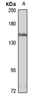 Timeless Rabbit Polyclonal Antibody