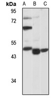 Tim44 Rabbit Polyclonal Antibody