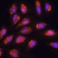 Tim44 Rabbit Polyclonal Antibody