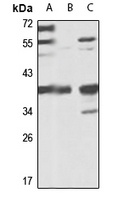Tim50 Rabbit Polyclonal Antibody