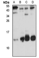 TIMM8B Antibody
