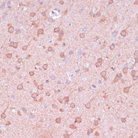 TIMM8B Antibody