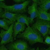 TIMM8B Antibody