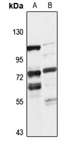 TIPARP Antibody