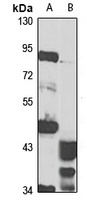 TM9SF3 Antibody