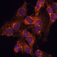 Anti-TMED2 Antibody