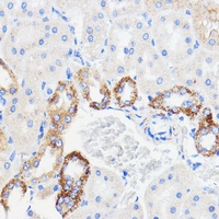 Anti-TMED3 Antibody