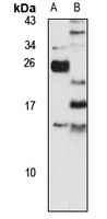 TMEM100 Rabbit Polyclonal Antibody