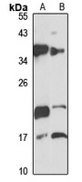 TMEM126A Rabbit Polyclonal Antibody
