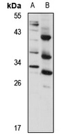 TMEM176B Antibody