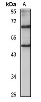 TMEM44 Rabbit Polyclonal Antibody