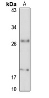 TMEM70 Rabbit Polyclonal Antibody