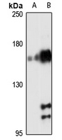 ARA160 Rabbit Polyclonal Antibody