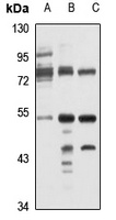 TMPRSS11D Rabbit Polyclonal Antibody
