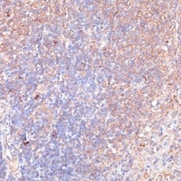 TMX1 antibody