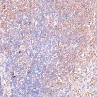 Anti-TMX1 Antibody