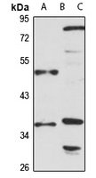 TOB Rabbit Polyclonal Antibody