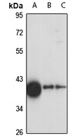 TOM40 Rabbit Polyclonal Antibody