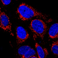 TOM40 Rabbit Polyclonal Antibody