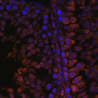 TPD52L3 Antibody