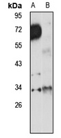 Tryptase beta-2 Rabbit Polyclonal Antibody