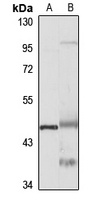 TRAM1 Rabbit Polyclonal Antibody