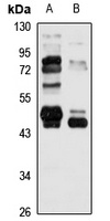DNMT2 Rabbit Polyclonal Antibody