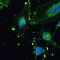 Anti-TREM2 Antibody